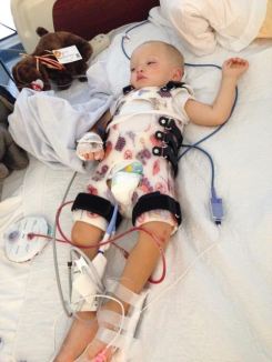 Carson, day after surgery fitted for brace