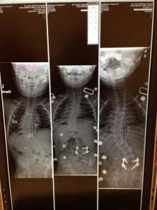 carson xray comparisons